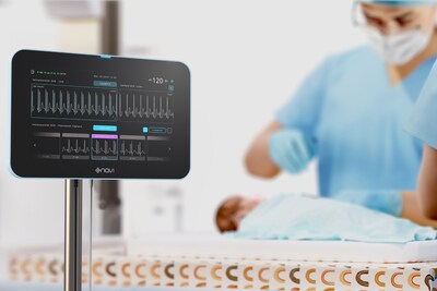 Neonav® ECG Tip Location System in a neonatal clinical setting. Developed by Navi Medical Technologies, Neonav uses real-time intravascular ECG to support central venous access device tip placement and ongoing migration surveillance.