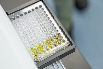 Precision indoxyl sulfate (IS) testing serves as a vital adjunct in assessing renal function, bridging the gap left by traditional biomarkers to secure a critical window for early clinical intervention. (Image: Leadgene Biomedical)
